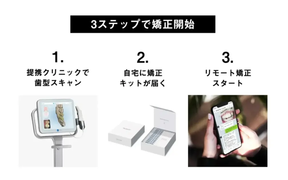 3ステップで矯正開始