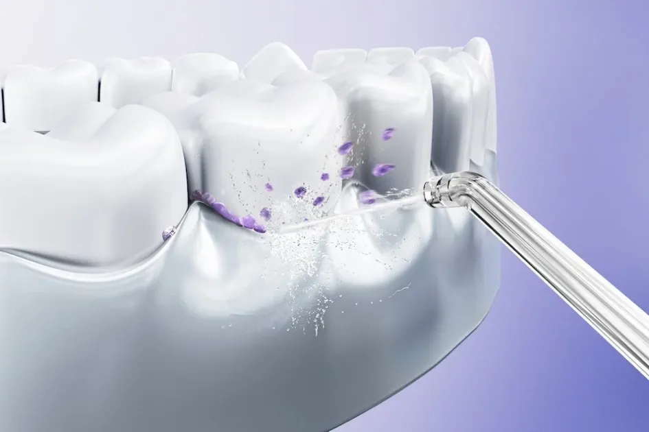 歯垢除去のイメージ