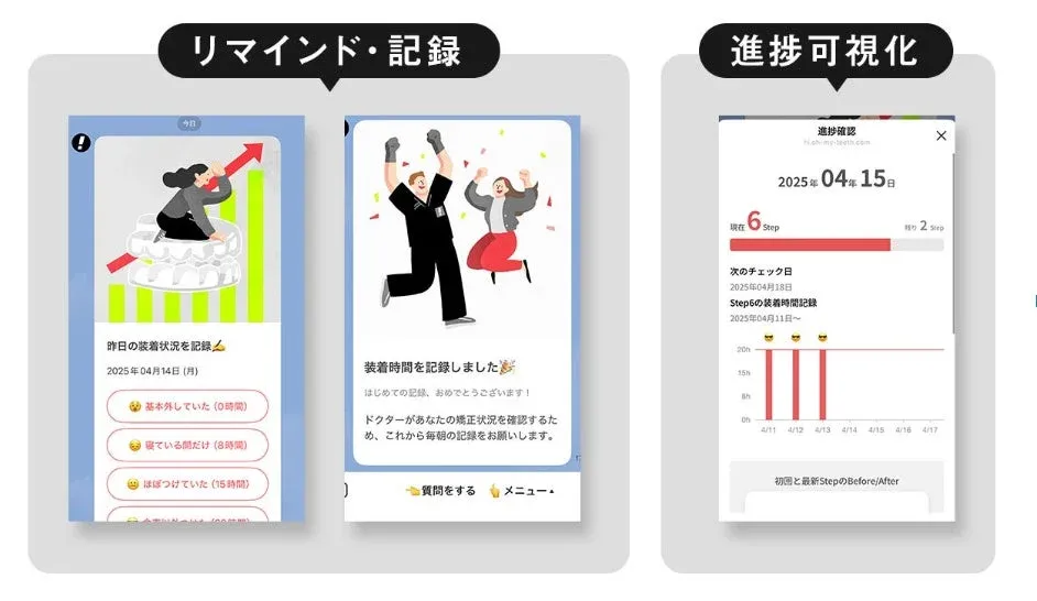 LINEでの伴走サポート