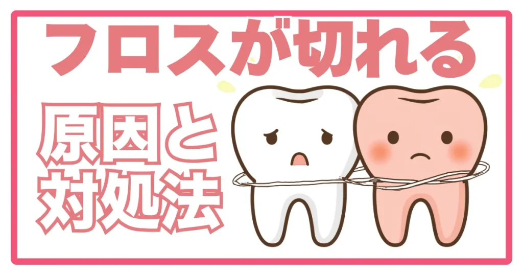 フロスが切れる・引っかかる原因と対処法