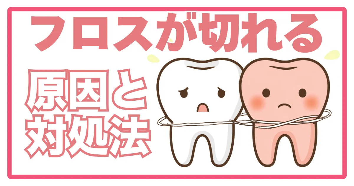 フロスが切れる・引っかかる原因と対処法