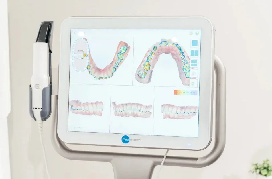 iTero Element口腔内スキャナーのディスプレイ